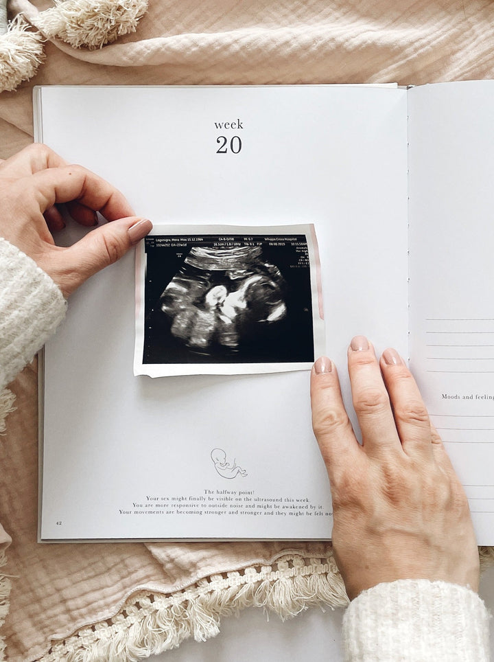 Pregnancy Journal